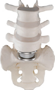 Artificial Disk Replacement in the Lumbar Spine