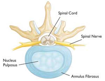 Cervical Radiculopathy (Pinched Nerve)