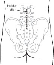 lower back